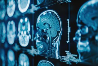 neurologia - nmedica